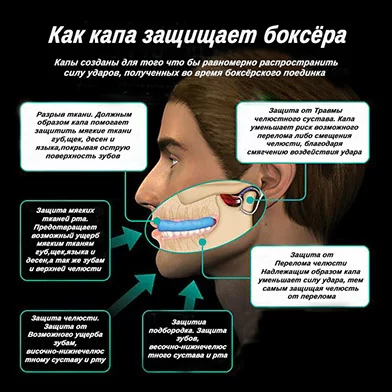 Капа одночелюстная боксерская Фото Капа одночелюстная боксерская со склада магазина Спортев